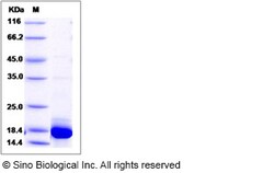 Sino Biological Recombinant Human LC3B Protein (His Tag), HPLC-verified,