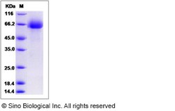 Sino Biological Human Discoidin / DCBLD1 Protein (His Tag) 50ug, Quantity: