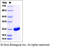 Sino Biological Recombinant Human TNFAIP8 Protein (His Tag), Quantity:
