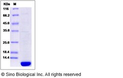 Sino Biological Recombinant Human ACBD7 Protein (His Tag), Quantity: Each