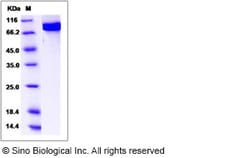 Sino Biological Recombinant Human 15 Lipoxygenase 2 Protein (His & GST
