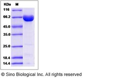 Sino Biological Recombinant Human 15 Lipoxygenase 2 Protein, Quantity: