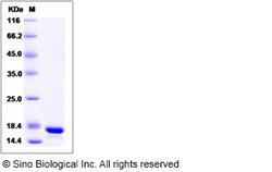 Sino Biological Recombinant Human GCSH Protein (His Tag), Quantity: Each