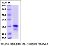 Sino Biological Recombinant Human CBFB Protein (His Tag), Quantity: Each