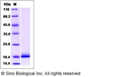 Sino Biological Recombinant Human VILIP1 Protein, Quantity: Each of 1