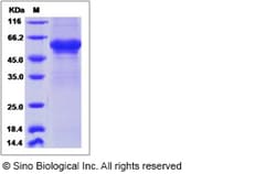Sino Biological Human CGB5 Protein (Fc Tag) 100ug, Quantity: Each of 1
