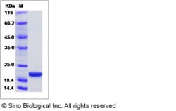Sino Biological Recombinant Human RKIP/PEBP1 Protein, Quantity: Each of
