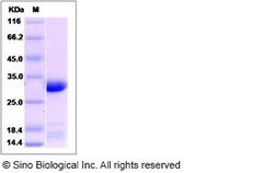Sino Biological Recombinant Human EEF1B2 Protein (His Tag), Quantity: Each