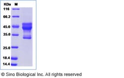 Sino Biological Human ARL6IP6 Protein (Fc Tag) 100ug, Quantity: Each of