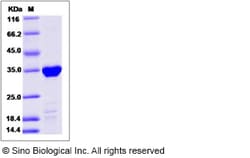 Sino Biological Recombinant Human TPM1 Protein (His Tag), Quantity: Each
