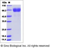 Sino Biological Recombinant Human Stomatin/STOM Protein (mFc Tag), Quantity: