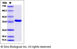 Sino Biological Human CBR3 / HCBR3 / Carbonyl Reductase 3 Protein (His