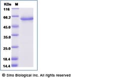 Sino Biological Recombinant Human NOTCH2NL Protein (mFc Tag), Quantity: