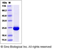 Sino Biological Recombinant Human TCTP/TPT1 Protein (His Tag), Quantity: