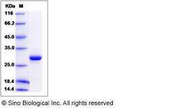 Sino Biological Human ETHE1 / HSCO Protein (His Tag) 100ug, Quantity: Each