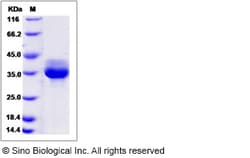 Sino Biological Human STX7 / Syntaxin 7 Protein (His Tag) 100ug, Quantity: