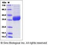 Sino Biological Recombinant Human PPT1 Protein (His Tag), Quantity: Each