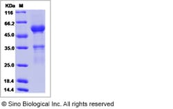 Sino Biological Recombinant Human ABO Protein (hFc Tag), Quantity: Each