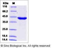 Sino Biological Human ACAA1 / PTHIO Protein (His Tag) 500ug, Quantity: