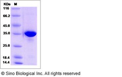 Sino Biological Recombinant Human Alpha SNAP Protein (His Tag), Quantity: