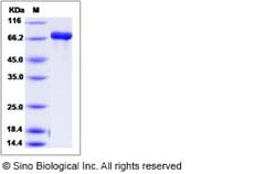 Sino Biological Recombinant Human DPYS Protein (His & GST Tag), Quantity: