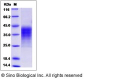 Sino Biological Recombinant Human LIF Protein (His Tag), Quantity: Each