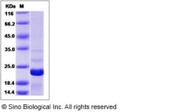 Sino Biological Recombinant Human EIF5A2 Protein (His Tag), Quantity: Each