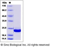 Sino Biological Recombinant Human ARF5 Protein (His Tag), Quantity: Each