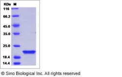 Sino Biological Recombinant Human Centrin 2 Protein (His Tag), Quantity: