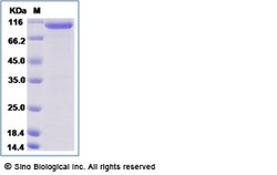 Sino Biological Human PFKP Protein (His & GST Tag) 50ug, Quantity: Each
