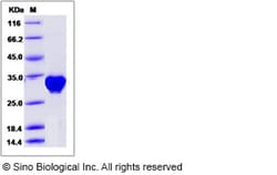 Sino Biological Human PLS3 / Plastin 3 Protein (His Tag) 100ug, Quantity: