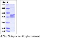 Sino Biological Recombinant Human MRPL44 Protein (His Tag), Quantity: Each
