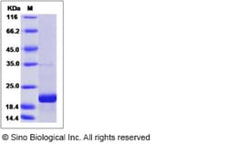 Sino Biological Recombinant Human eIF5A Protein (His Tag), Quantity: Each