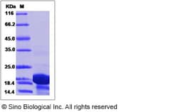 Sino Biological Recombinant Human TPPP2 Protein (His Tag), Quantity: Each