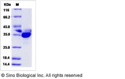 Sino Biological Human PRPS2 Protein (His Tag) 50ug, Quantity: Each of 1