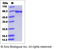 Sino Biological Human ACTR3 Protein (His & GST Tag) 100ug, Quantity: Each