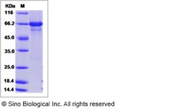 Sino Biological Recombinant Human Pellino-1 Protein (His & GST Tag), Quantity: