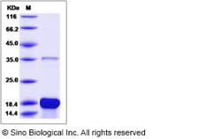 Sino Biological Recombinant Human DBI Protein (His Tag), Quantity: Each