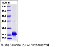 Sino Biological Recombinant Human RBP7 Protein (His Tag), Quantity: Each