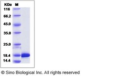 Sino Biological Recombinant Human RBP5 Protein (His Tag), Quantity: Each