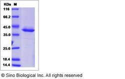 Sino Biological Recombinant Human DEFB127 Protein (hFc Tag), Quantity: