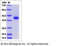 Sino Biological Recombinant Human LY6D Protein (mFc Tag), Quantity: Each