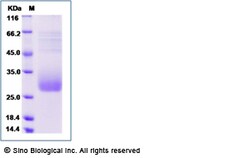 Sino Biological Human LACRT Protein (His Tag) 100ug, Quantity: Each of