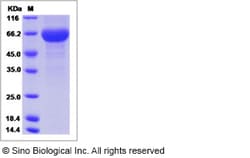 Sino Biological Human Pregnancy Specific Glycoprotein 1 Protein (His Tag)
