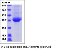 Sino Biological Human CHRNB3 Protein (ECD, His Tag) 100ug, Quantity: Each