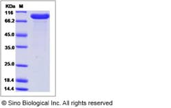 Sino Biological Recombinant Human APCDD1 Protein (hFc Tag), Quantity: Each