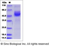 Sino Biological Recombinant Human GPIHBP1 Protein (hFc Tag), Quantity: