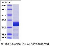 Sino Biological Human TPK1 Protein (His Tag) 50ug, Quantity: Each of 1