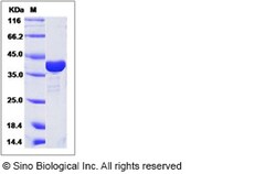 Sino Biological Human ADPRH / ARH1 Protein (His Tag) 100ug, Quantity: Each