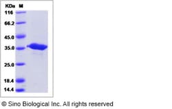 Sino Biological Recombinant Human GGPS1 Protein (His Tag), Quantity: Each